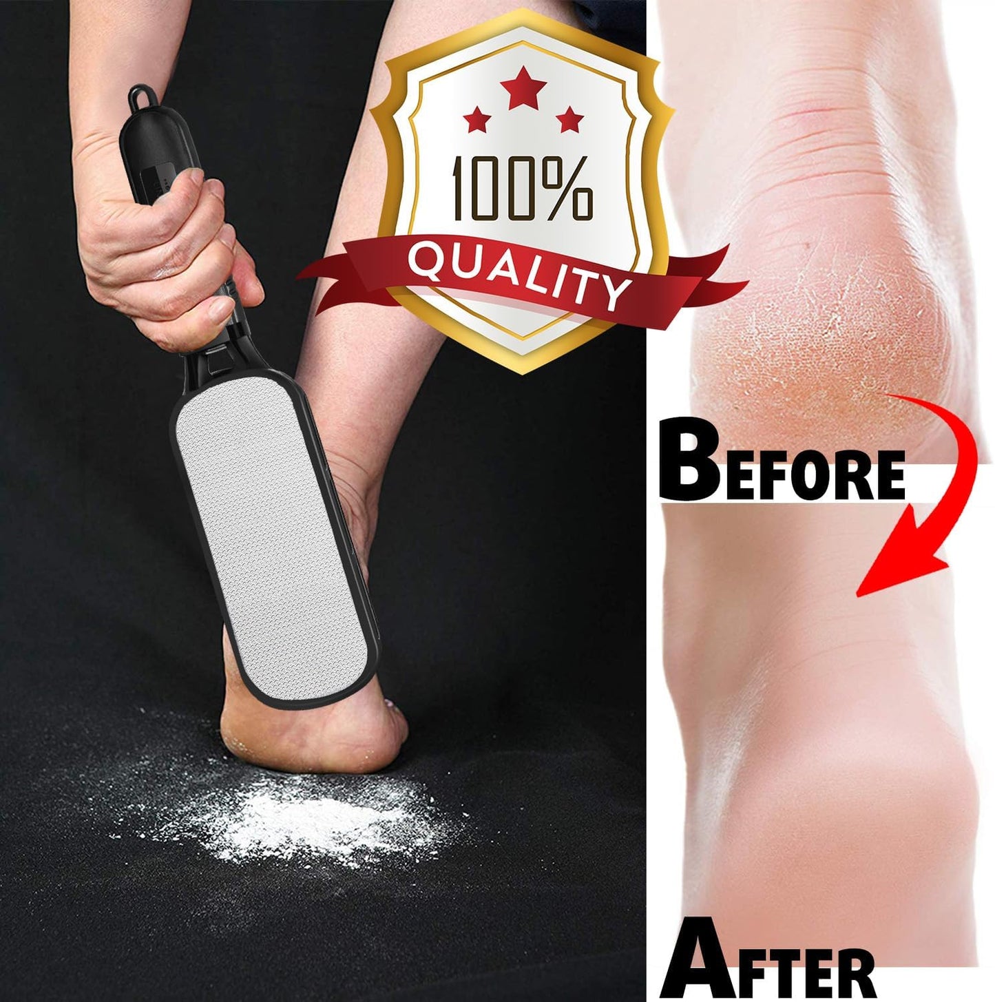 Foot File and Callus Remover - Stainless Steel Pedicure Tool for Dead Skin and Cracked Heels