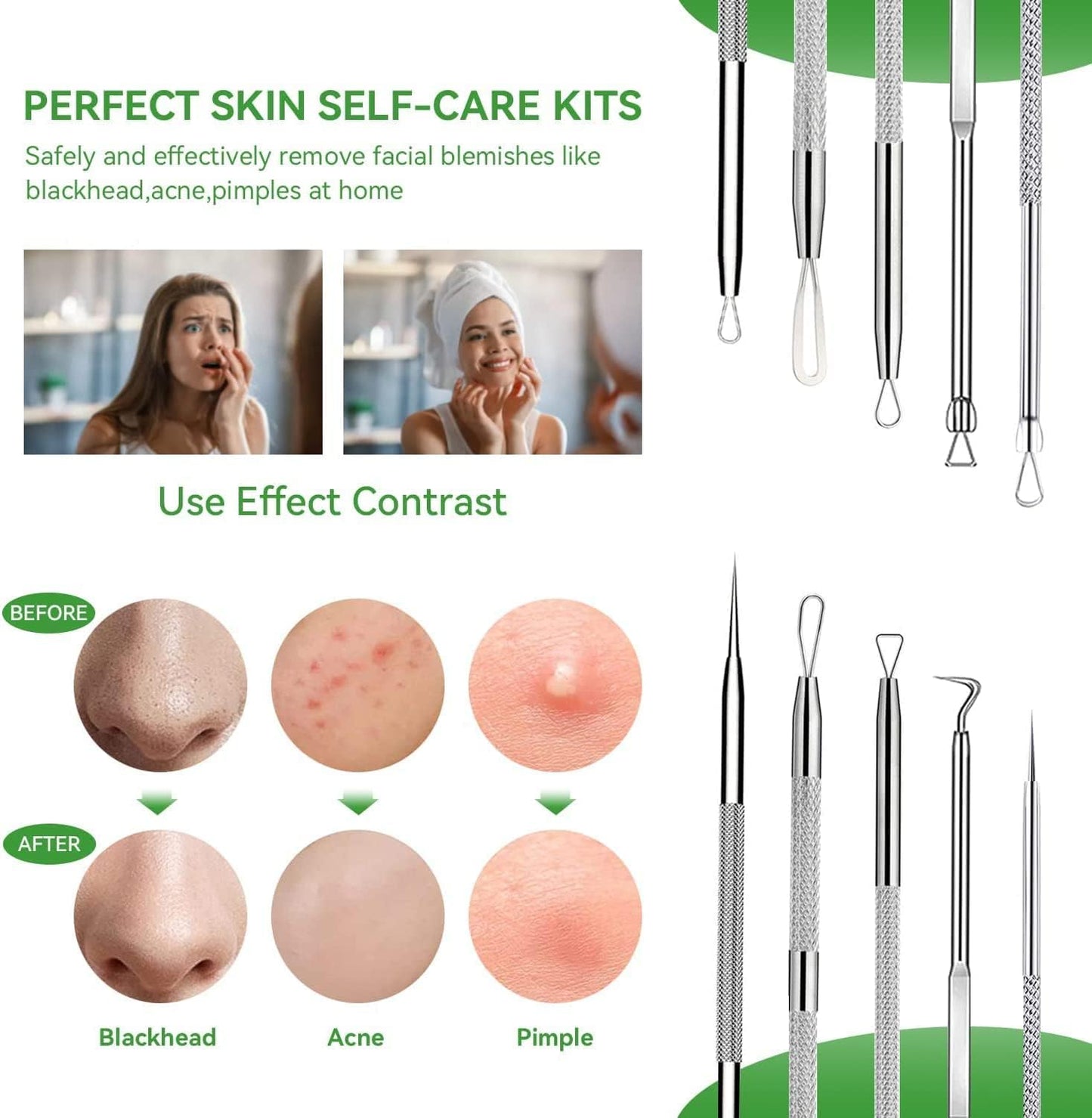Stainless Steel Blackhead Remover Tool Kit - 5-Piece Pimple Extractor Set for Facial Skin Care, Comedone and Acne Treatment