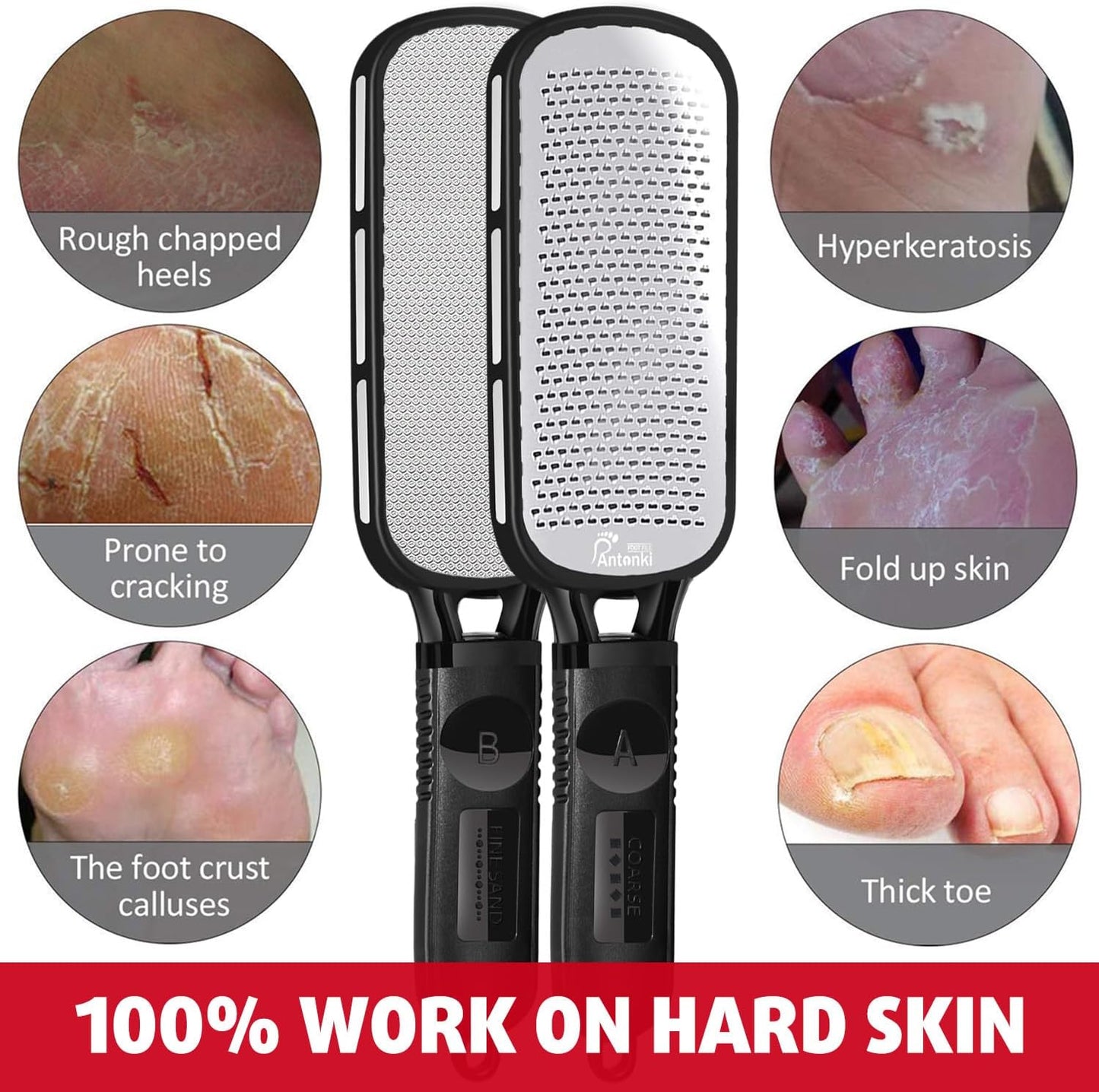 Foot File and Callus Remover - Stainless Steel Pedicure Tool for Dead Skin and Cracked Heels