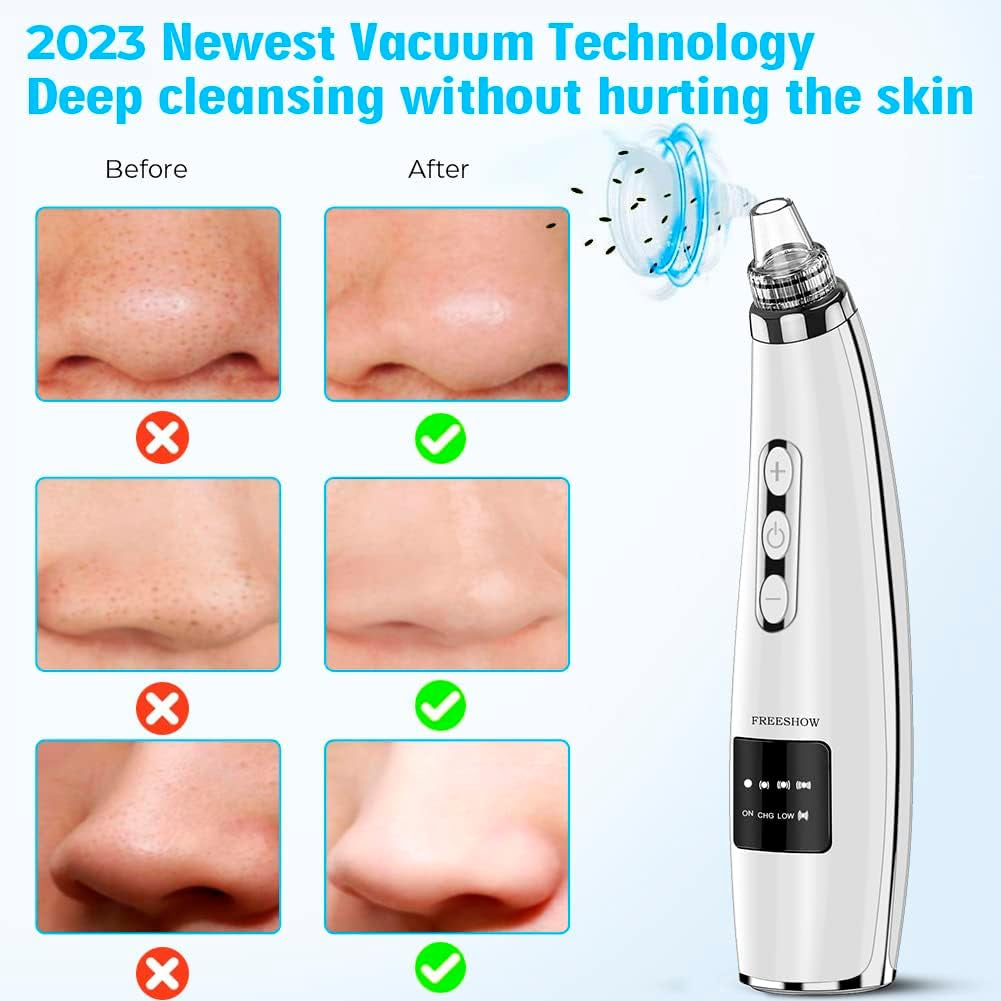 Upgraded Electric Blackhead Remover and Pore Vacuum - 5 Suction Levels, 5 Probes, USB Rechargeable Comedone Extractor Kit for Men and Women