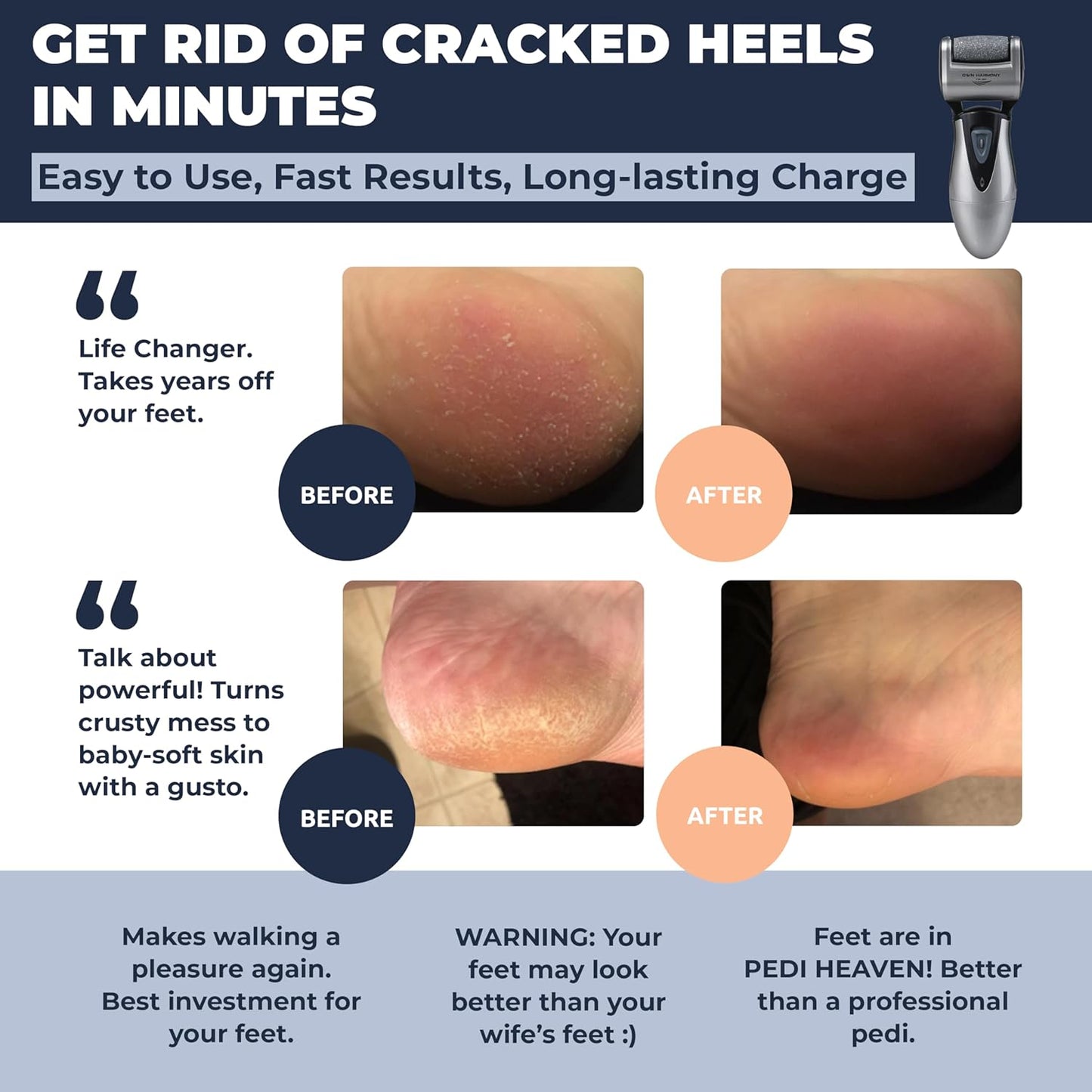 Electric Rechargeable Callus Remover for Men and Women with 3 Powerful Rollers - Professional Spa Quality Micro Pedi Foot Care Tool for Cracked Skin