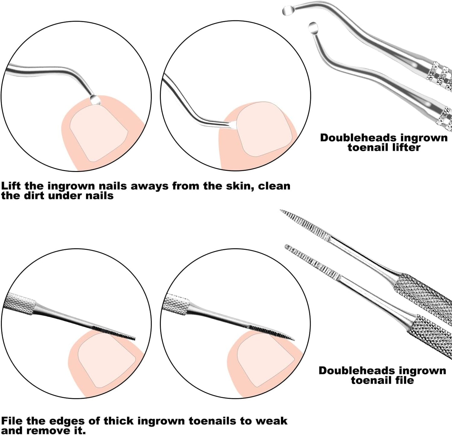 7-Piece Stainless Steel Ingrown Toenail Removal Kit with Under Nail Cleaner and Pedicure Tools