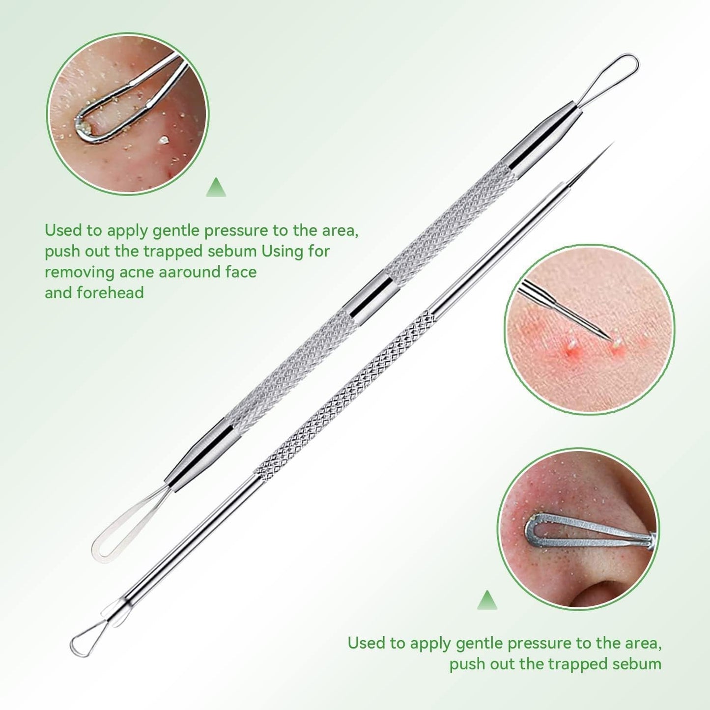 Stainless Steel Blackhead Remover Tool Kit - 5-Piece Pimple Extractor Set for Facial Skin Care, Comedone and Acne Treatment